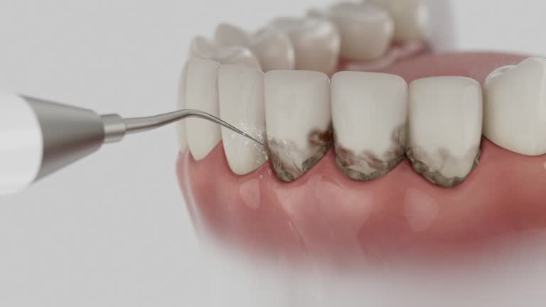Trusted Emergency Dentist service in Houston, MO - Dentist Open Now